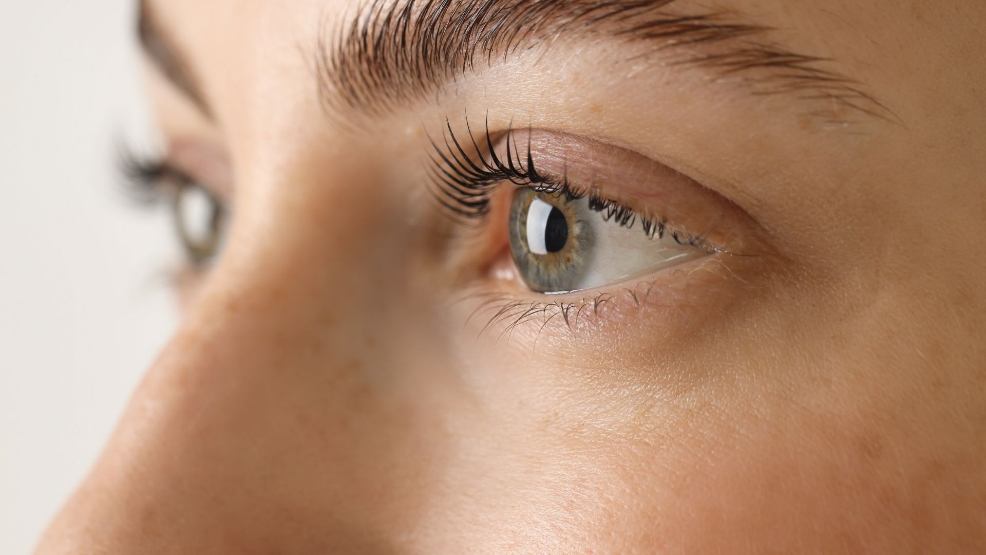 Endoscopic Brow Lift